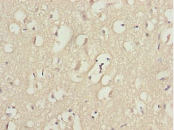 KPNA5 Antibody
