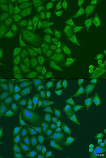 SUGCT / C7orf10 Antibody