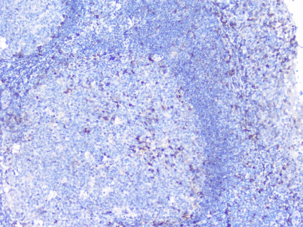 Polyclonal Rabbit anti-Human PTP1B Antibody (IHC, WB)