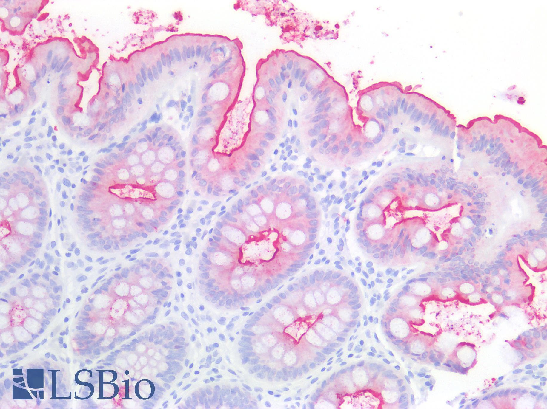 IHC-plus™ CEA / Carcinoembryonic Antigen Antibody