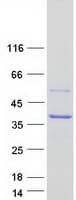 Human SCAMP1 / SCAMP Protein (Recombinant Myc-DDK (Flag))