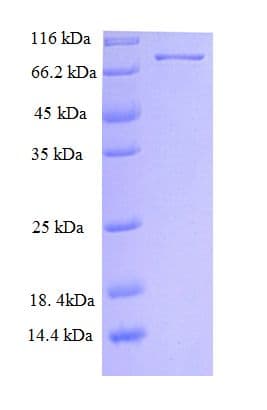Human NET1 / ARHGEF8 Protein (Recombinant His-SUMO)