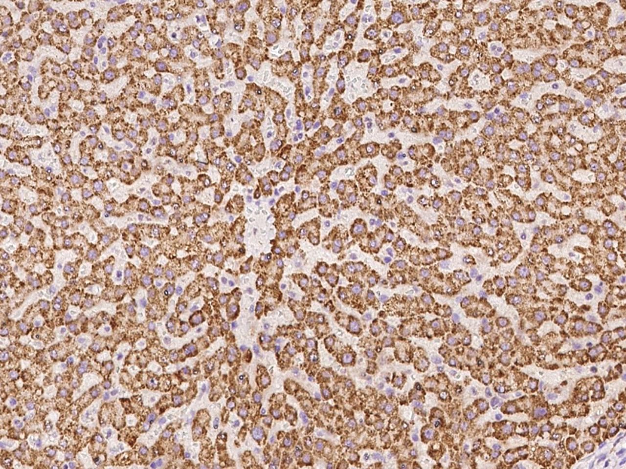 PECR Antibody