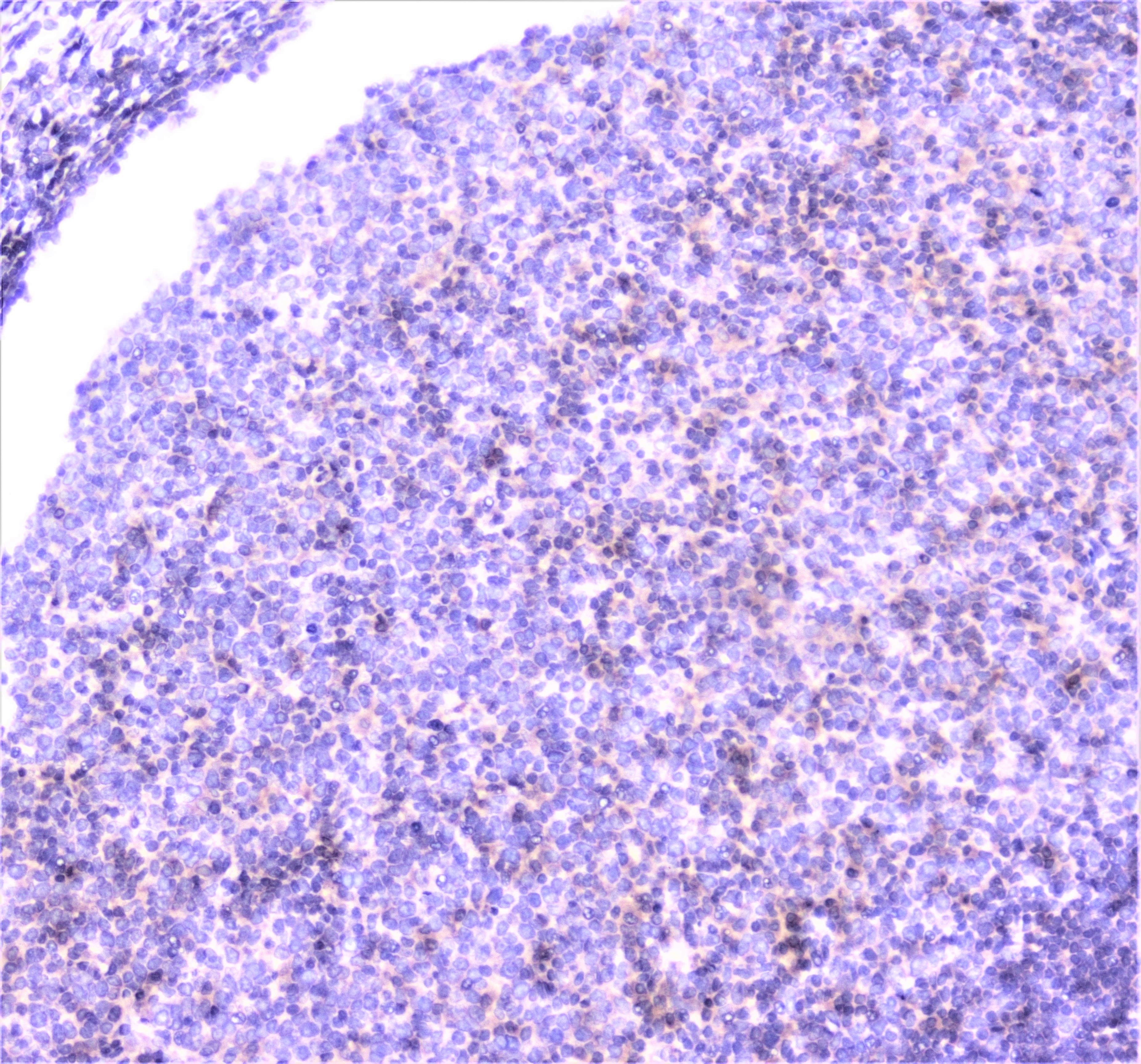 UBE2I / UBC9 Antibody