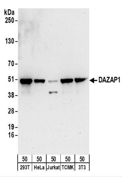 Polyclonal Rabbit anti-Human DAZAP1 Antibody (aa50-100, WB)