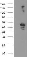 EIF2B3 Antibody (clone OTI2H1)