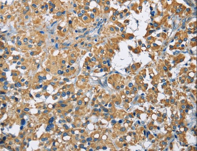 ZMYND11 / BS69 Antibody