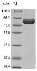 Zebrafish HYKK / AGPHD1 Protein (Recombinant 10His-SUMO, N-terminus + Myc, C-terminus)