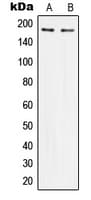 Polyclonal Rabbit anti-Human IRS1 Antibody (Internal, IHC, IF, WB)