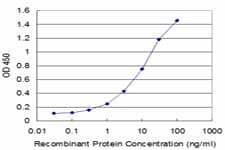 SMC3 / HCAP Antibody (clone 2F11)