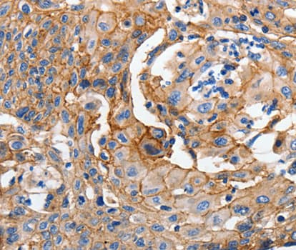 CDH1 / E Cadherin Antibody