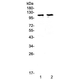 Polyclonal Rabbit anti-Mouse STAT2 Antibody (WB)