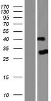 PTPN20 Protein (Over-Expression Lysate Myc-DDK (Flag))
