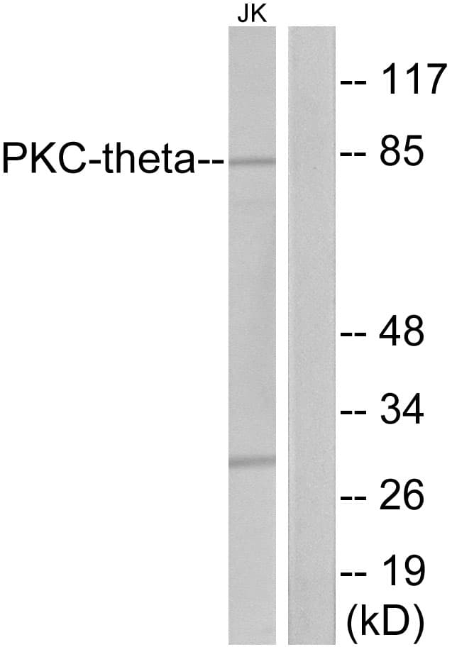IHC-plus™ PRKCQ / PKC-Theta Antibody (aa643-692)