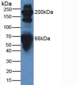 Complement C3 Antibody (aa1322-1661)
