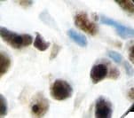 Monoclonal Mouse anti-Human WT1 / Wilms Tumor 1 Antibody (clone 6F-H2, Ready-to-Use, IHC)