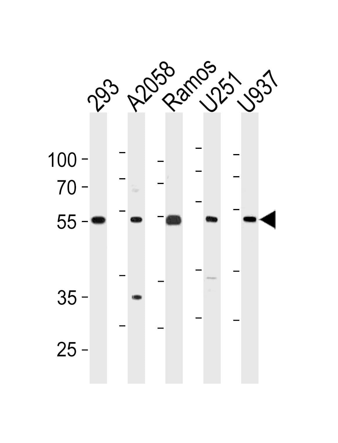 CDCA7L Antibody (aa290-317)