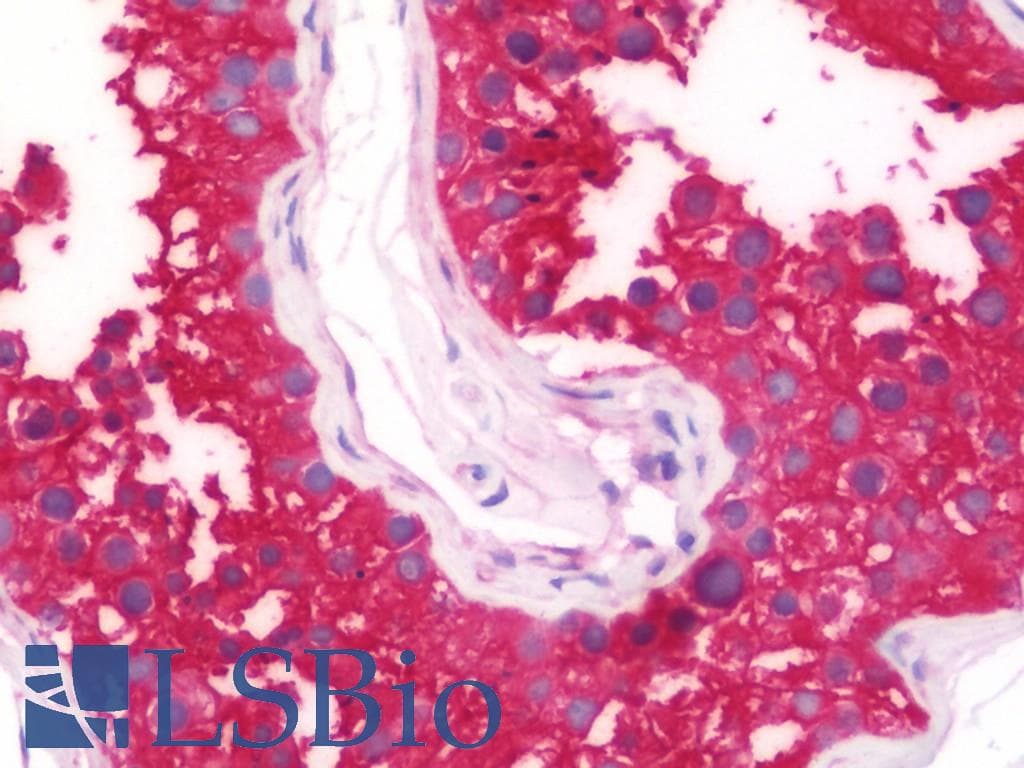 IHC-plus™ Polyclonal Rabbit anti-Human Gravin / AKAP12 Antibody (aa1719-1782, IHC, WB)