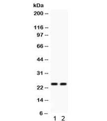 Polyclonal Rabbit anti-Human LCN2 / Lipocalin 2 / NGAL Antibody (IHC, WB)
