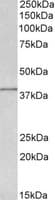 IHC-plus™ IDH3G Antibody (aa337-350)