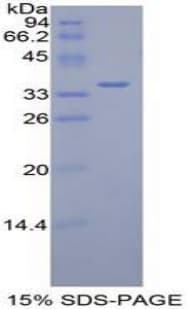 Mouse DISPA / DISP1 Protein (Recombinant His-T7)