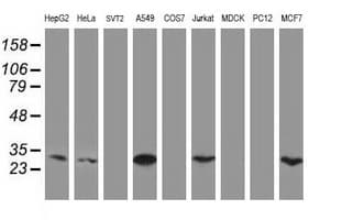 Monoclonal Mouse anti-Human IF3mt / MTIF3 Antibody (clone OTI1D6, IHC, WB)