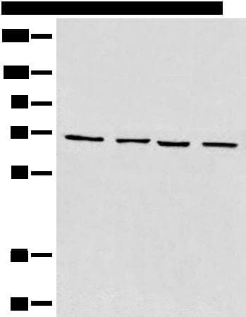 Polyclonal Rabbit anti-Human MAPK4 / ERK4 Antibody (IHC, WB)