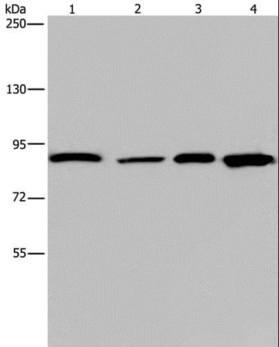 JUP/CTNNG/Junction Plakoglobin Antibody
