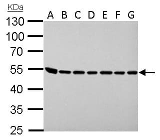 ASL / Argininosuccinate Lyase Antibody (aa13-261)