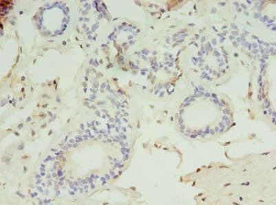 Polyclonal Rabbit anti-Human LYPLAL1 Antibody (IHC)