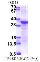 Human PCSK1N / PROSAAS Protein (Recombinant His)