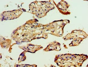 ACAT2 Antibody (aa1-97)