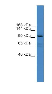 XYLT1 / XylT-I Antibody (aa551-600)