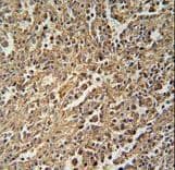 Polyclonal Rabbit anti-Human ENGASE Antibody (aa326-354, IHC, WB)