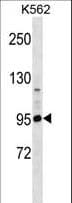 Polyclonal Rabbit anti-Human PCDHA4 Antibody (aa761-790, WB)