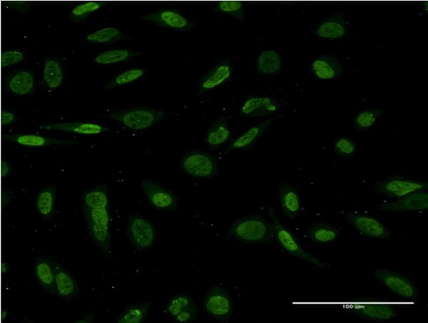 NKX2-1 / Thyroid-Specific TF Antibody (clone 2B9)