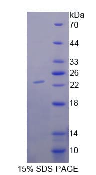 Human LCAT Protein (Recombinant His-T7)