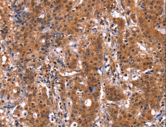 GUK1 / Guanylate Kinase 1 Antibody