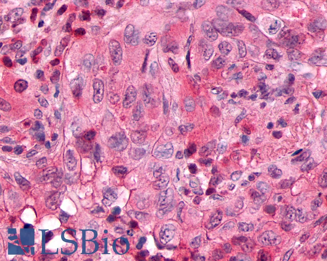 PathPlus™ SSTR3 Antibody (C-Terminus)