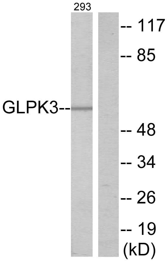 GK3 / Glycerol Kinase 3 Antibody