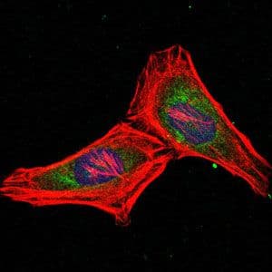 PSMB8 / LMP7 Antibody (clone 1A5)