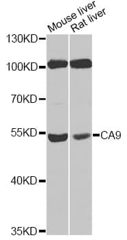 IHC-plus™ Polyclonal Rabbit anti-Human CA9 / Carbonic Anhydrase IX Antibody (IHC, WB)