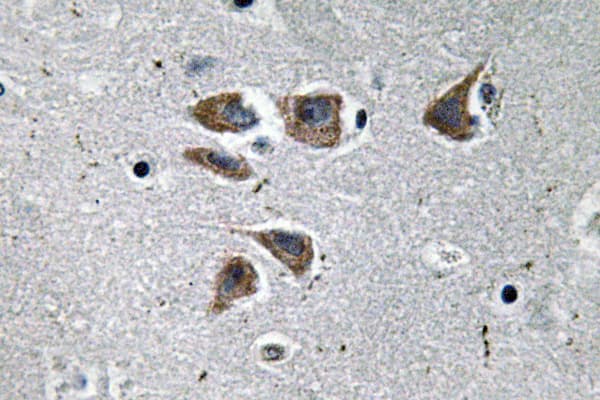 Neuropeptide Y / NPY Antibody (aa45-94)