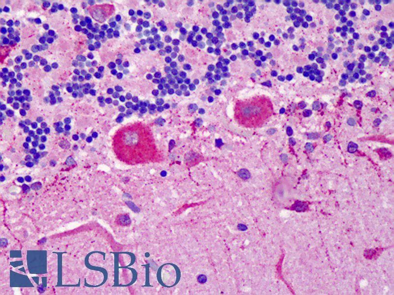 IHC-plus™ Polyclonal Rabbit anti-Human YWHAB / 14-3-3 Beta Antibody (IHC, IF, WB)