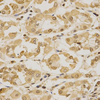SUMO1 / SMT3 Antibody