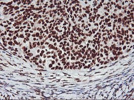GSTT2 Antibody (clone OTI6C4)