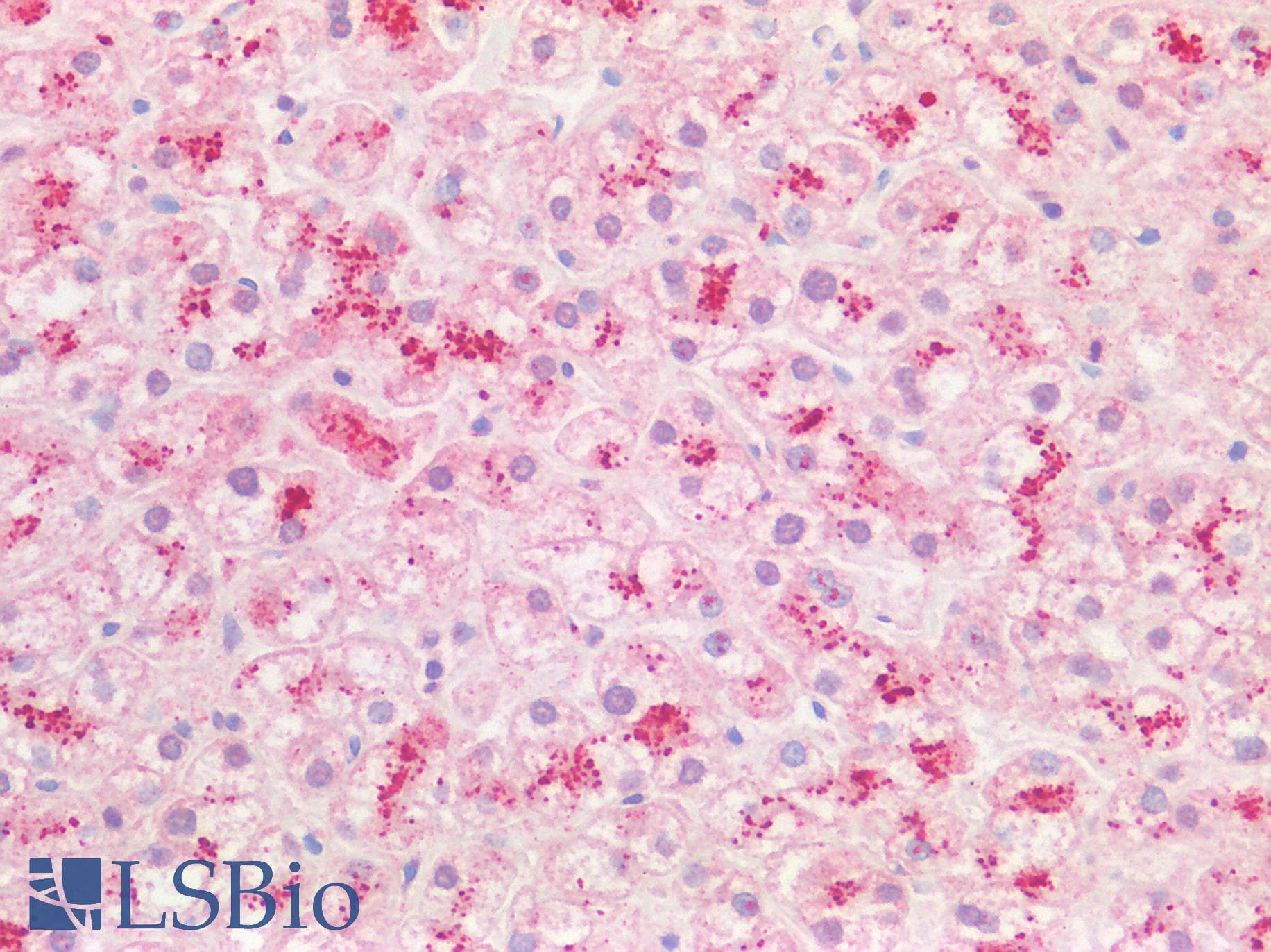 PPT1 / CLN1 Antibody (C-Terminus)