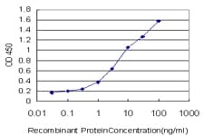ALPL / Alkaline Phosphatase Antibody (clone 4H1)