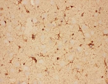 Polyclonal Rabbit anti-Mouse CNTF Antibody (aa2-198, IHC, WB)