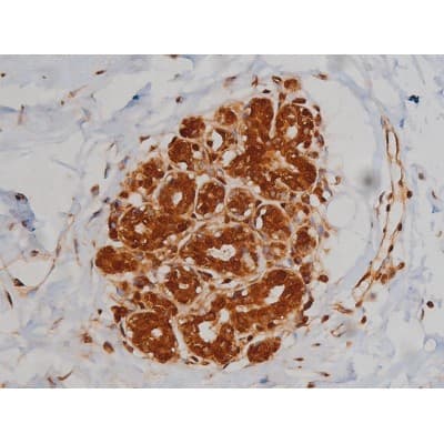 IGF1R / IGF1 Receptor Antibody (phospho-Tyr1346)